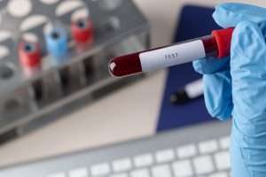 quanto dura il cbd nelle urine